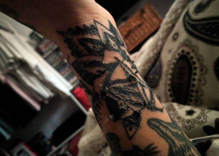 What is tattoo peeling?