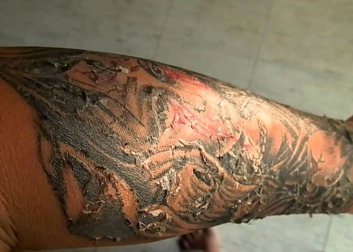 What You Should Do When Your Tattoo Starts Peeling