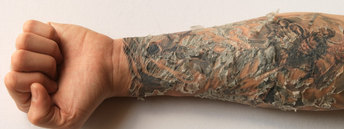 Tattoo care when peeling